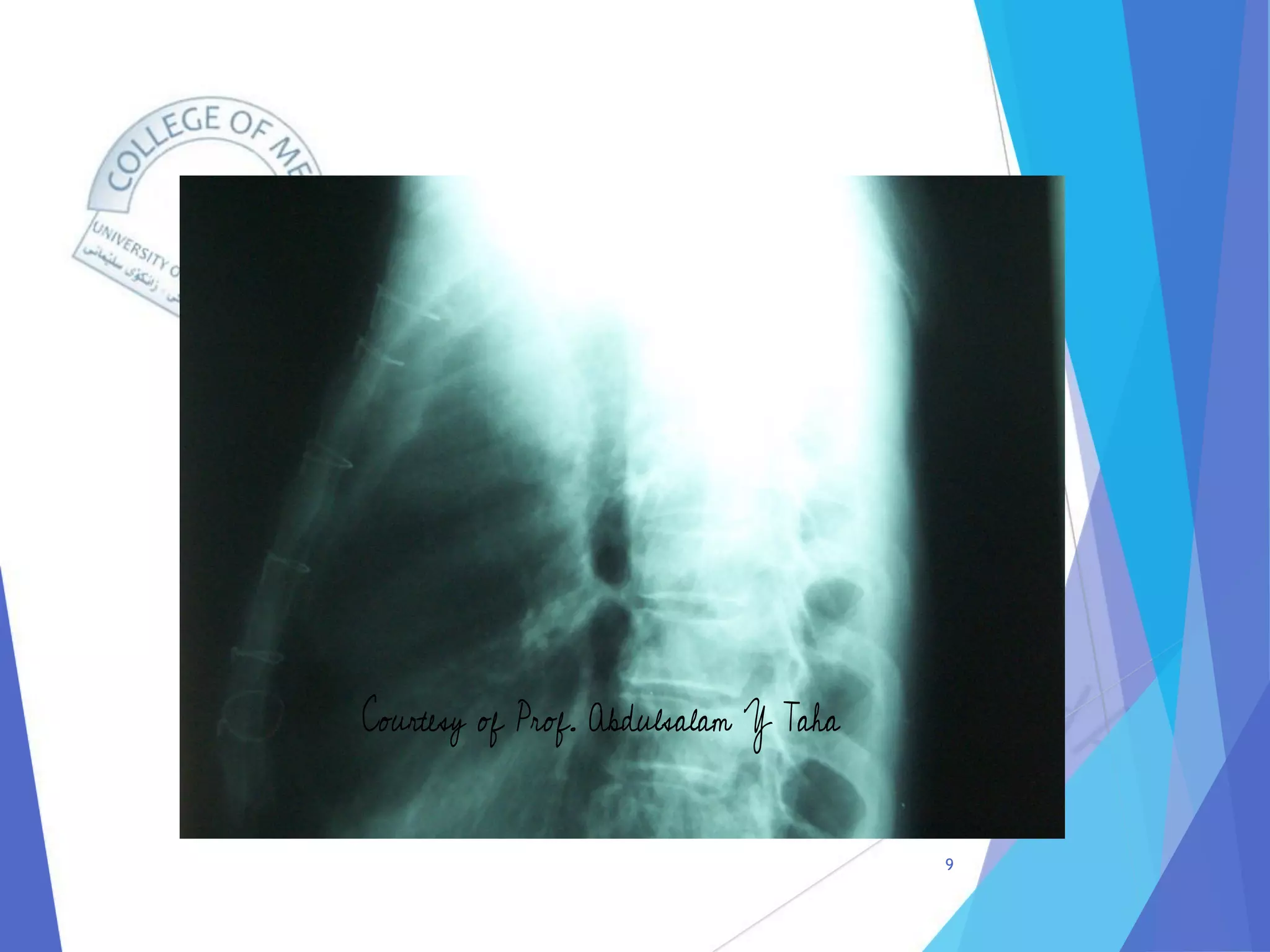 Radiology of Thoracic Aortic Aneurysms.pdf