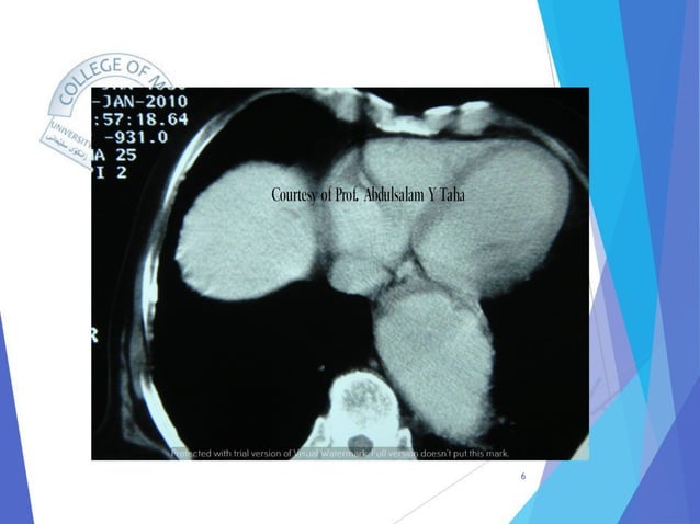 Radiology of Thoracic Aortic Aneurysms.pdf