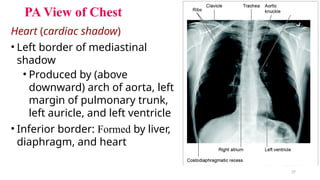 Aortic Shadow Comprehensive Radiological Examination of the Thoracic Cage and Chest ...