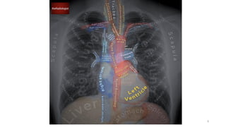 Comprehensive Radiological Examination of the Thoracic Cage and Chest ...