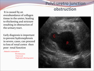 Radiology of urogenital systsm slide share | PPT