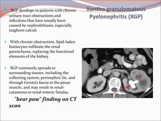 Xgp Radiology Radiology of urogenital systsm slide share | PPT