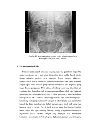 Gambar 10. Kontras tidak memenuhi vesica urinaria menandakan
kemungkin batu pada vesica urniaria.
3. Ultrasonography (USG)
Ultrasonography adalah salah satu imaging diagnostic (pencitraan diagnostik)
untuk pemeriksaan alat – alat tubuh, dimana kita dapat melihat bentuk tubuh,
ukuran anatomis, gerakan, serta hubungan dengan jaringan sekitarnya.
Pemeriksaan ini bersifat non invasif, tidak menimbulka rasa sakit, dapat dilakukan
dengan cepat, aman, dan data yang diperoleh mempunyai nilai diagnostik yang
tinggi. Prinsip penggunaan USG adalah gelombang suara yang dihasilkan leh
transduser akan dipantulkan oleh jaringan yang ada didalam tubuh kita. Frekuensi
gelombang suara dihasilkan oleh kristal – kristal yang ada di dalam transduser
mencapai 1 -10 MHz (1-10 Juta Hz) sehingga manusia tidak dapat mendengarnya.
Gelombang suara yang diterima oleh jaringan di tubuh tersebut akan dipantulkan
kembali ke dalam transduser dan diubah menjadi energi listrik oleh suatu efek
bernama piezo – electric. Energi listrik tersebut akan diperlihatkan kedalam
bentuk cahaya pada layar osiloskop. Masing – masing jaringan tubuh mempunyai
impendance acustic tertentu. Jaringan yang heterogen akan ditimbulkan
bermacam – macam eko disebut echogenic. Sedangkan, jaringan yang homogeny
 