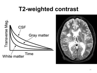 T2-weighted contrast
24
 