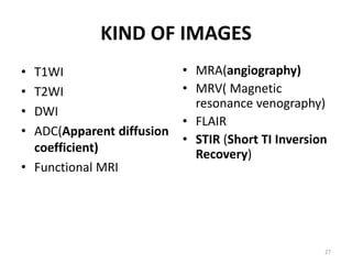 KIND OF IMAGES
• T1WI
• T2WI
• DWI
• ADC(Apparent diffusion
coefficient)
• Functional MRI
• MRA(angiography)
• MRV( Magnetic
resonance venography)
• FLAIR
• STIR (Short TI Inversion
Recovery)
27
 