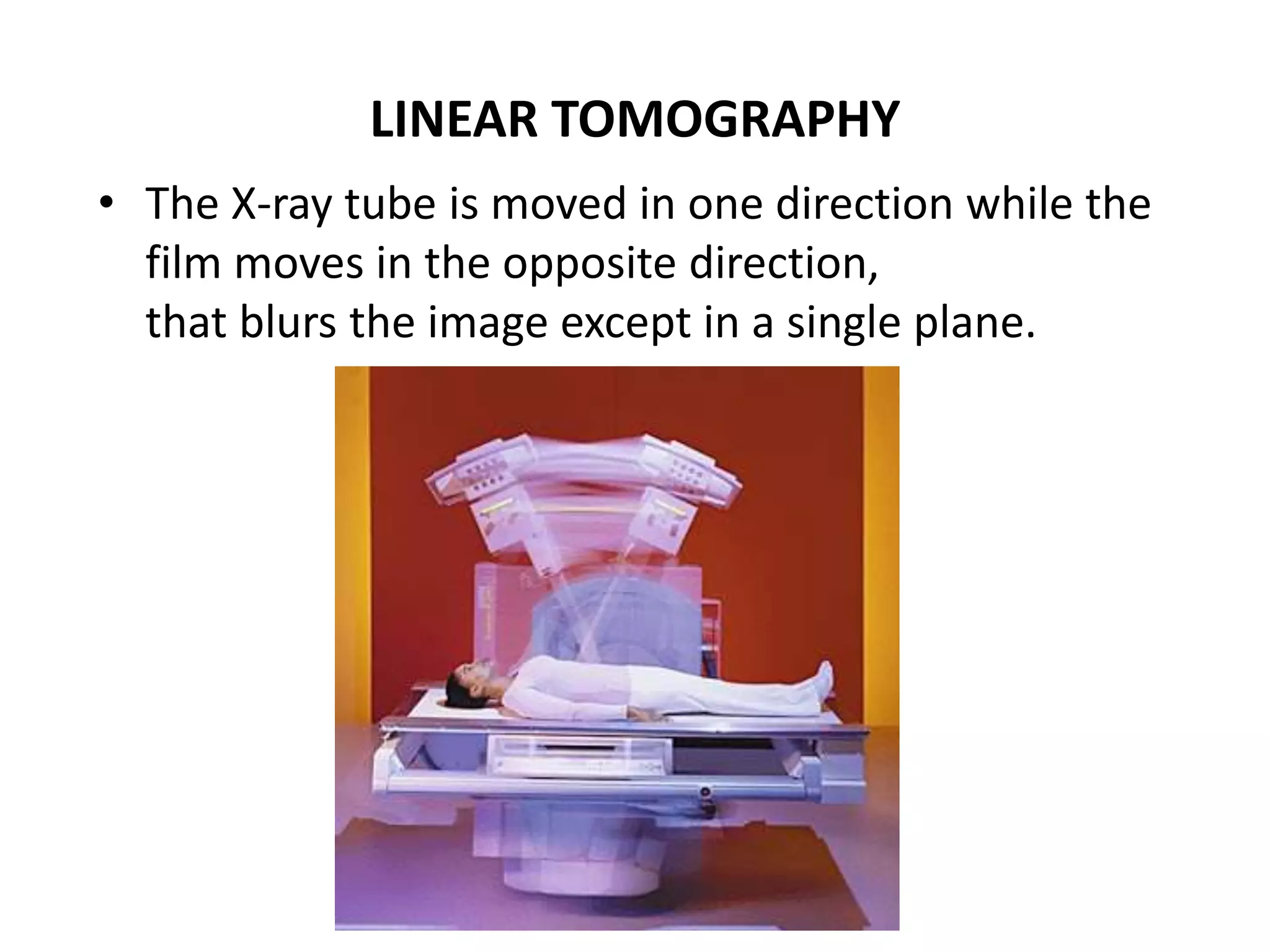 LINEAR TOMOGRAPHY
• The X-ray tube is moved in one direction while the
film moves in the opposite direction,
that blurs the image except in a single plane.
 