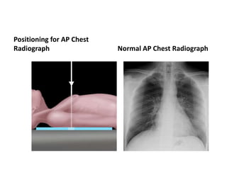 Radiology respiratory new.ppt