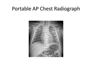 Radiology respiratory new.ppt