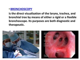 Bronchoscopy Visualization Radiology respiratory new.ppt