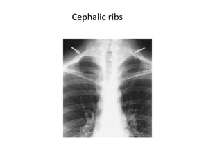 Radiology respiratory new.ppt