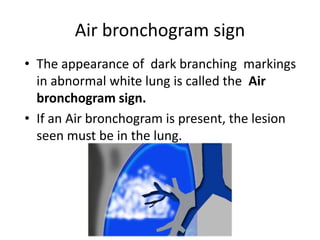 Radiology respiratory new.ppt