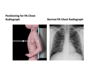 Chest Position Radiology respiratory new.ppt