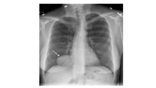 Radiology revision note including different spots from different ...