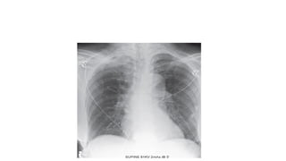 Radiology revision note including different spots from different ...