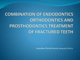 Australian Dental Journal 2004;43:(1):28-31 
 