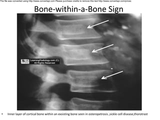 Classical radiology signs by shah zeb.pdf