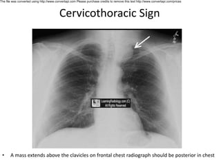 Classical radiology signs by shah zeb.pdf