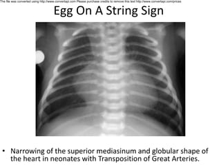 Classical radiology signs by shah zeb.pdf
