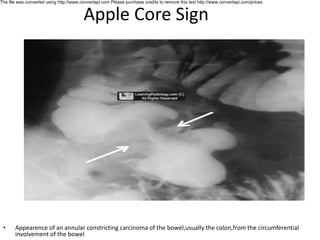 Classical radiology signs by shah zeb.pdf
