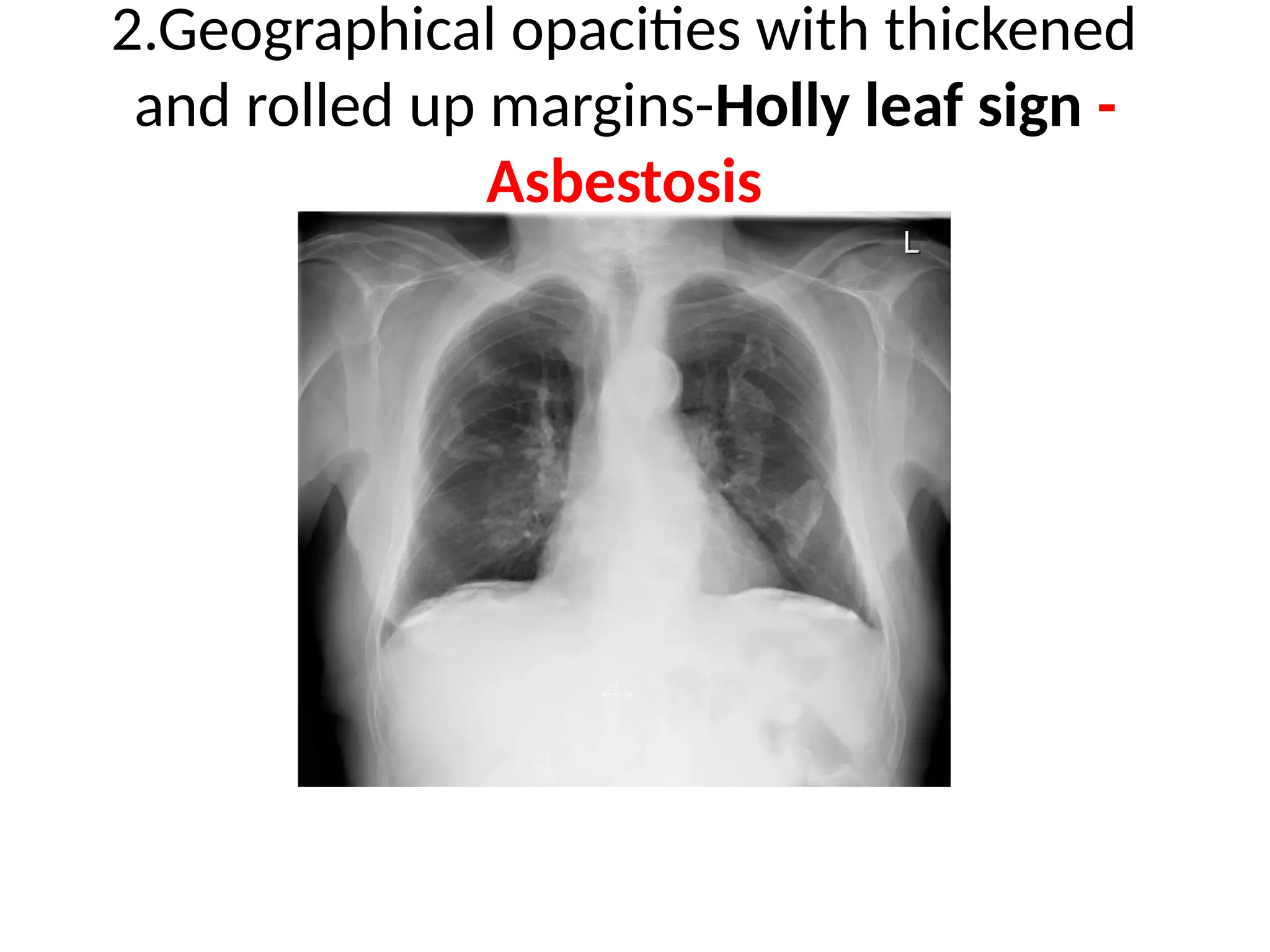 RADIOLOGY SIGNS JULY24 signs signs signed.pptx