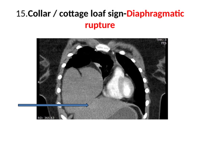 RADIOLOGY SIGNS JULY24 signs signs signed.pptx