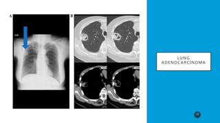 Radiology spotlight v2 | PPTX