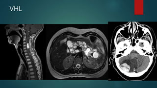 VHL
 