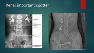 Renal important spotter
 