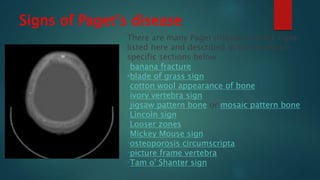 Signs of Paget’s disease
There are many Paget disease-related signs,
listed here and described in the modality-
specific sections below:
•banana fracture
•blade of grass sign
•cotton wool appearance of bone
•ivory vertebra sign
•jigsaw pattern bone or mosaic pattern bone
•Lincoln sign
•Looser zones
•Mickey Mouse sign
•osteoporosis circumscripta
•picture frame vertebra
•Tam o' Shanter sign
 