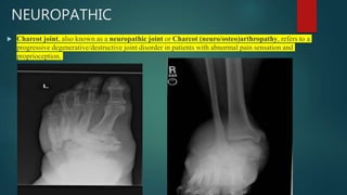 NEUROPATHIC
 Charcot joint, also known as a neuropathic joint or Charcot (neuro/osteo)arthropathy, refers to a
progressive degenerative/destructive joint disorder in patients with abnormal pain sensation and
proprioception.
 