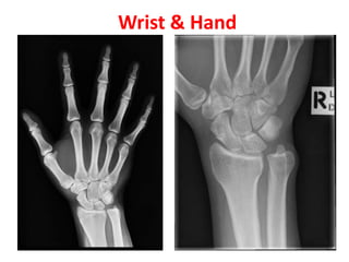 Wrist & Hand
 