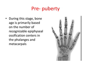 Pre- puberty
• During this stage, bone
age is primarily based
on the number of
recognizable epiphyseal
ossification centers in
the phalanges and
metacarpals
 