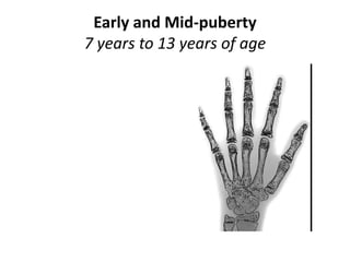 Early and Mid-puberty
7 years to 13 years of age
 