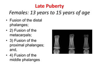 Late Puberty
Females: 13 years to 15 years of age
• Fusion of the distal
phalanges;
• 2) Fusion of the
metacarpals;
• 3) Fusion of the
proximal phalanges;
and,
• 4) Fusion of the
middle phalanges
 