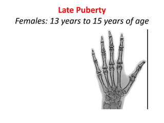 Late Puberty
Females: 13 years to 15 years of age
 