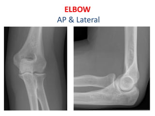 ELBOW
AP & Lateral
 