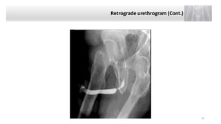 Retrograde Urethrogram Radiograph Radiology Urinary system Presentation 2022 (2).pptx