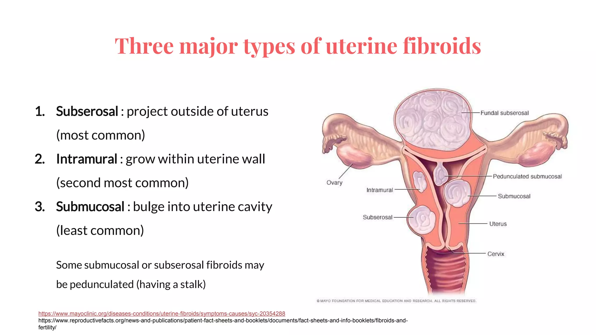 diagnostic-imaging-in-uterine-fibroids-potx