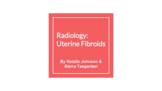 Radiology:
Uterine Fibroids
By Natalie Johnson &
Sierra Teegarden
 