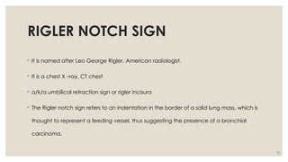 Radiology Lot Class: Key Radiological Signs in Pulmonary Medicine | PPTX
