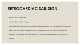 Radiology Lot Class: Key Radiological Signs in Pulmonary Medicine | PPTX