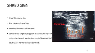 Radiology in pulmo cases part 2 in depth | PPTX
