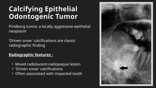 Radiolucent unilocular lesion final.pptx
