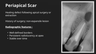 Scar Gamma Radiography Radiolucent unilocular lesion final.pptx