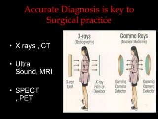 Accurate Diagnosis is key to
Surgical practice
• X rays , CT
• Ultra
Sound, MRI
• SPECT
, PET

 