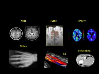 MRI

fMRI

SPECT

X-Ray
Ultrasound
CT

 