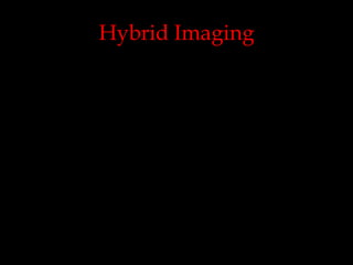 Hybrid Imaging

 