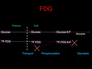 FDG
Plasma

Cell

Glucose

Glucose

Glucose-6-P

18F-FDG

18F-FDG

18F-FDG-6-P

Transport

Phosphorylation

Glycolysis

Glycolysis

 