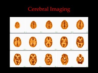 Cerebral Imaging

 