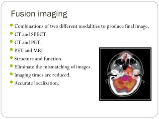 Fusion imaging
Combinations of two different modalities to produce final image.
CT and SPECT.
CT and PET.
PET and MRI
Structure and function.
Eliminate the mismatching of images.
Imaging times are reduced.
Accurate localization.
 